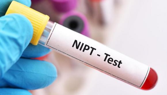 NIPT testen op meer Diagnovum locaties mogelijk
